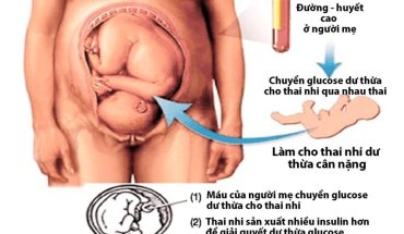 THAI TO CÓ NGUY HIỂM KHÔNG? NHỮNG ĐIỀU MẸ BẦU CẦN BIẾT